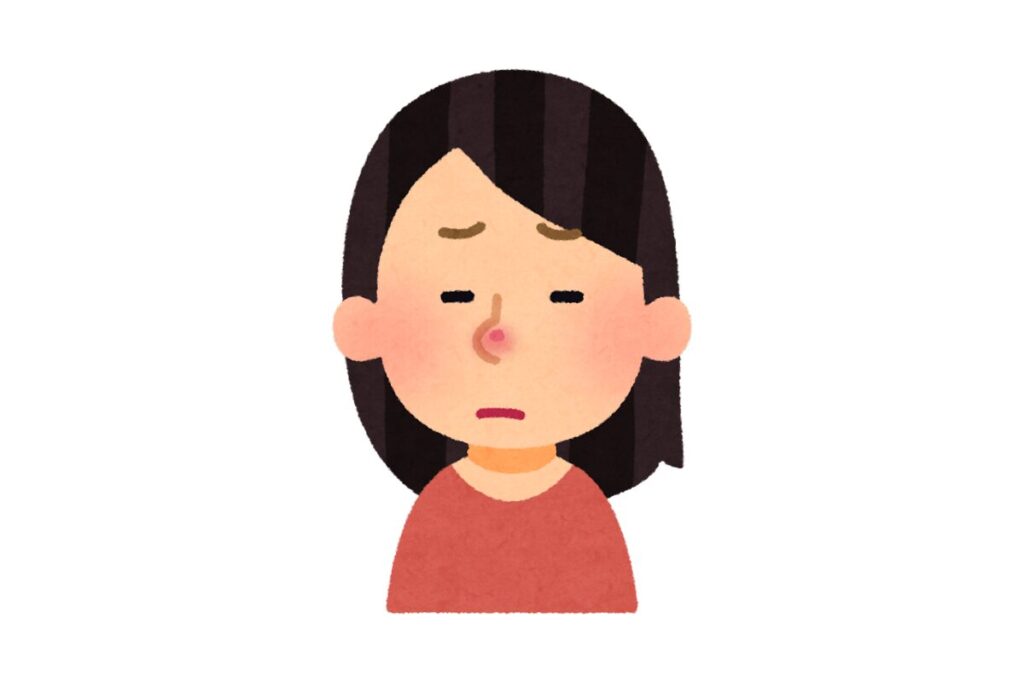 乾燥肌イメージ